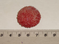 bladder stone removed from a dog